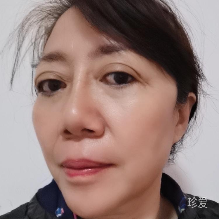 一點(diǎn)點(diǎn)