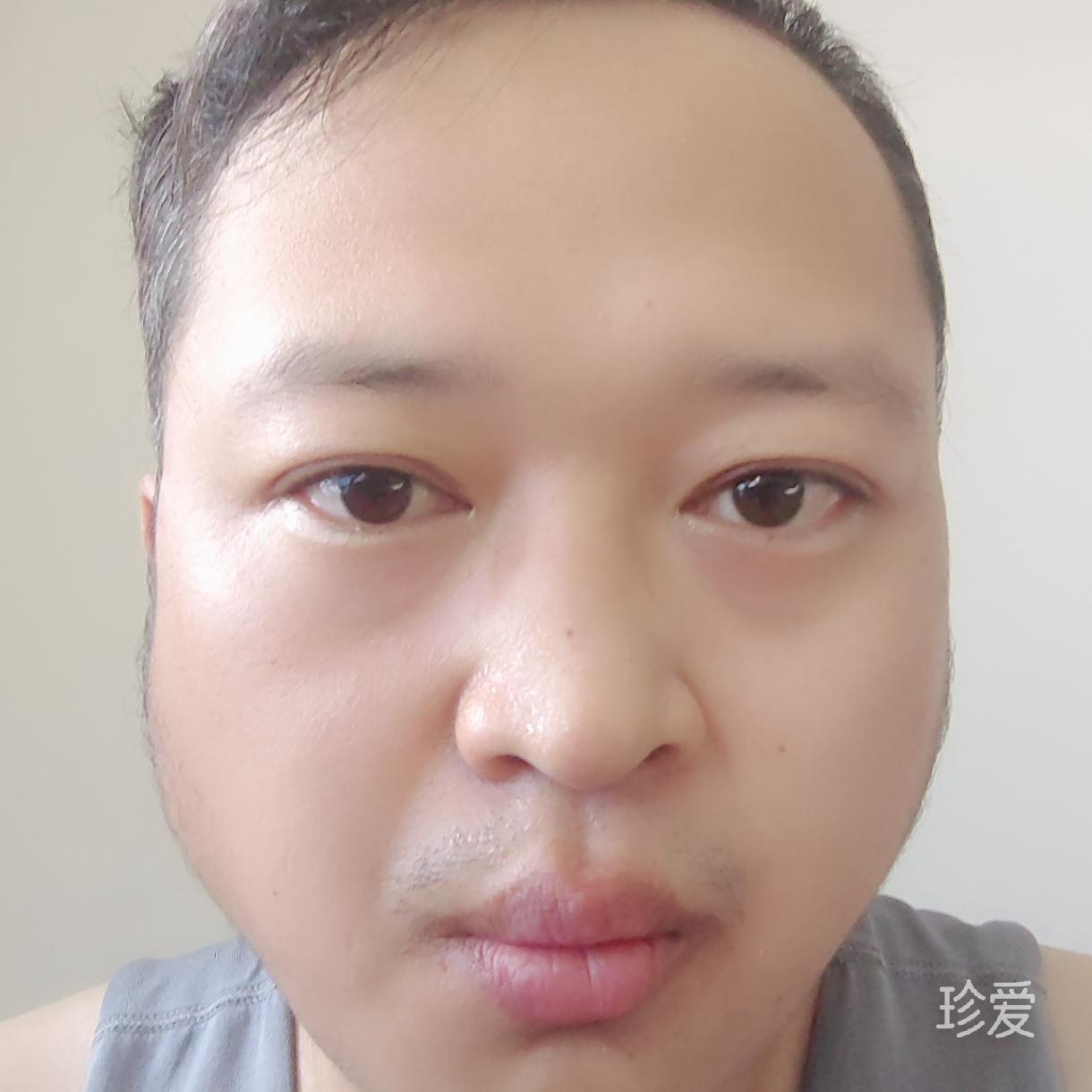 向锋