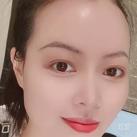 蓝精灵