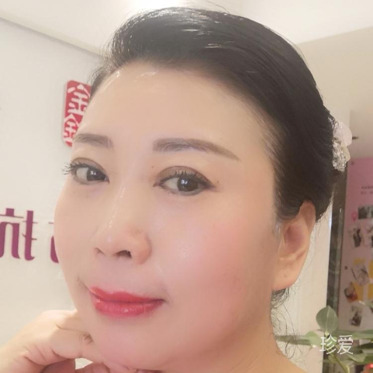 暖心