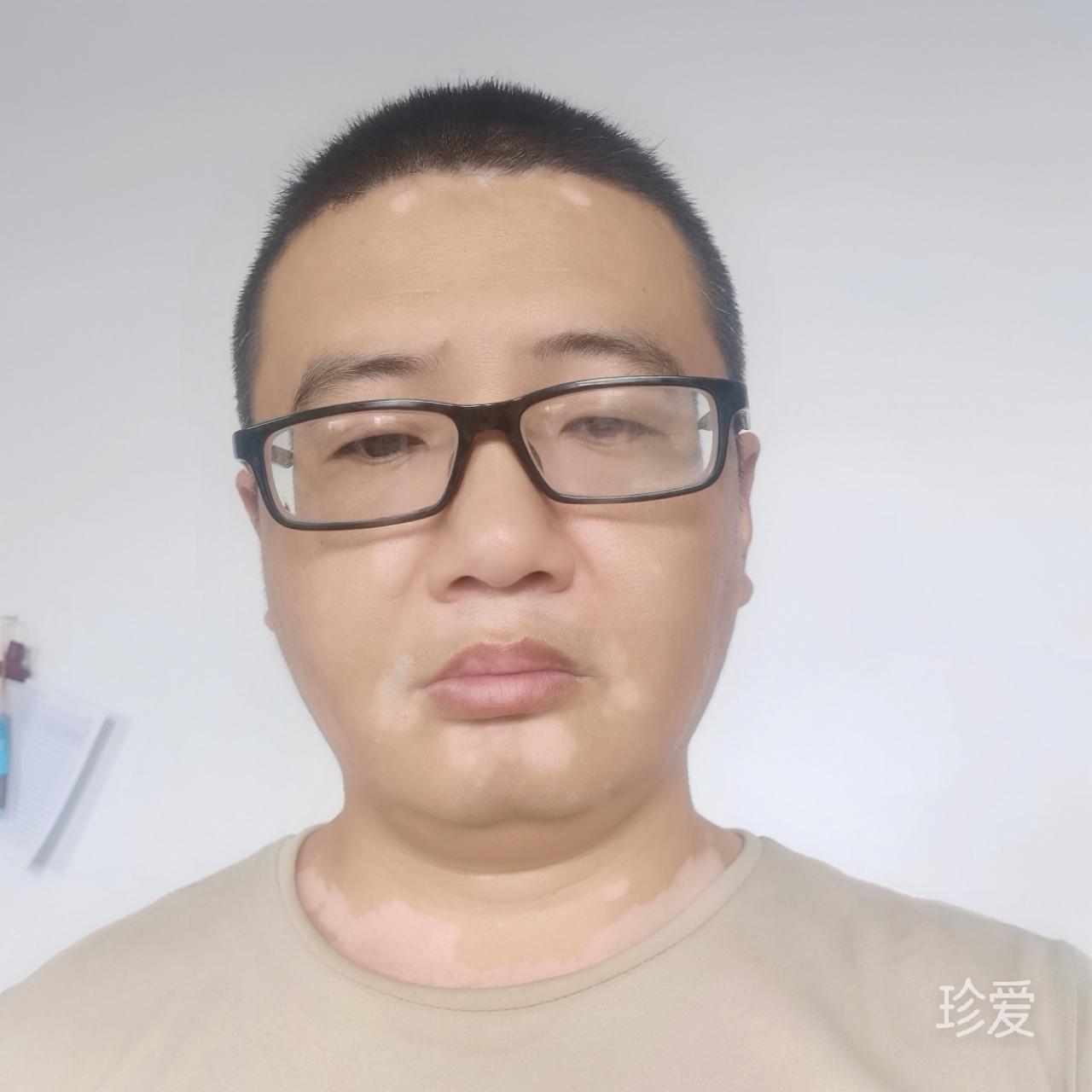 小小术士