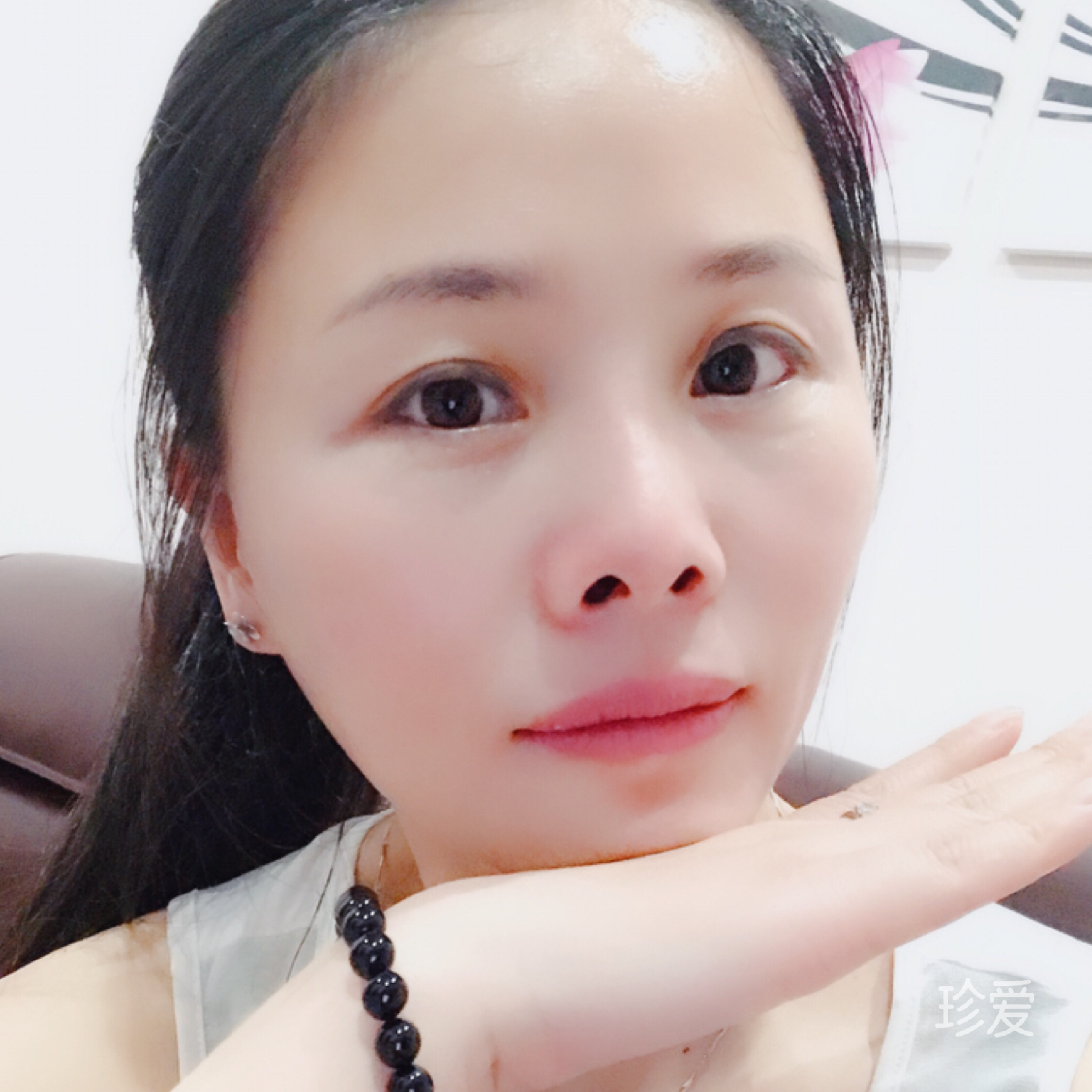 阳光