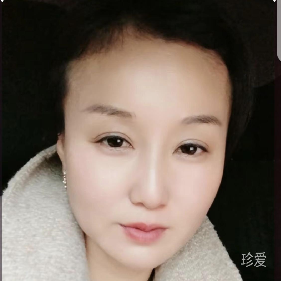 悉息