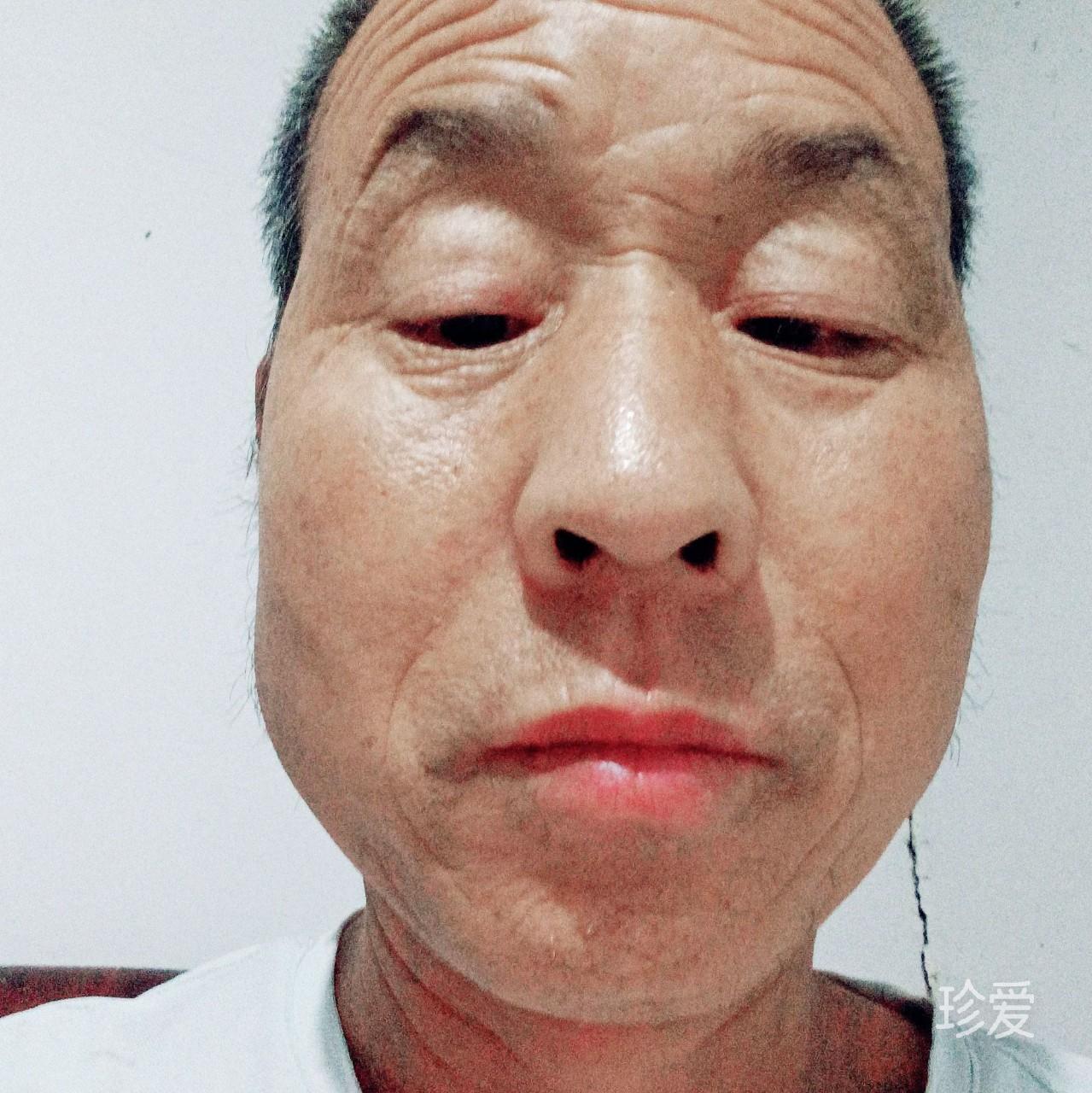受伤男人