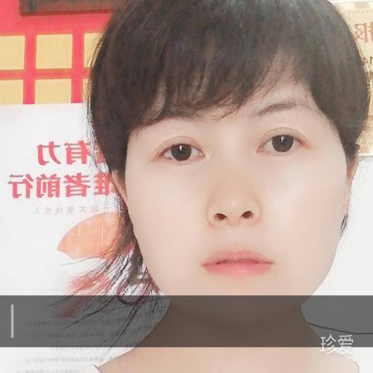 雪xue