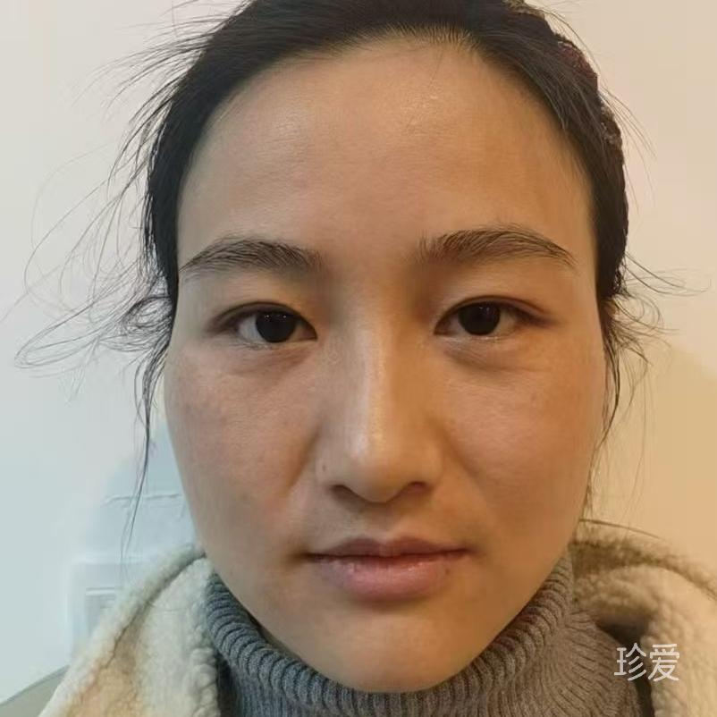 白白
