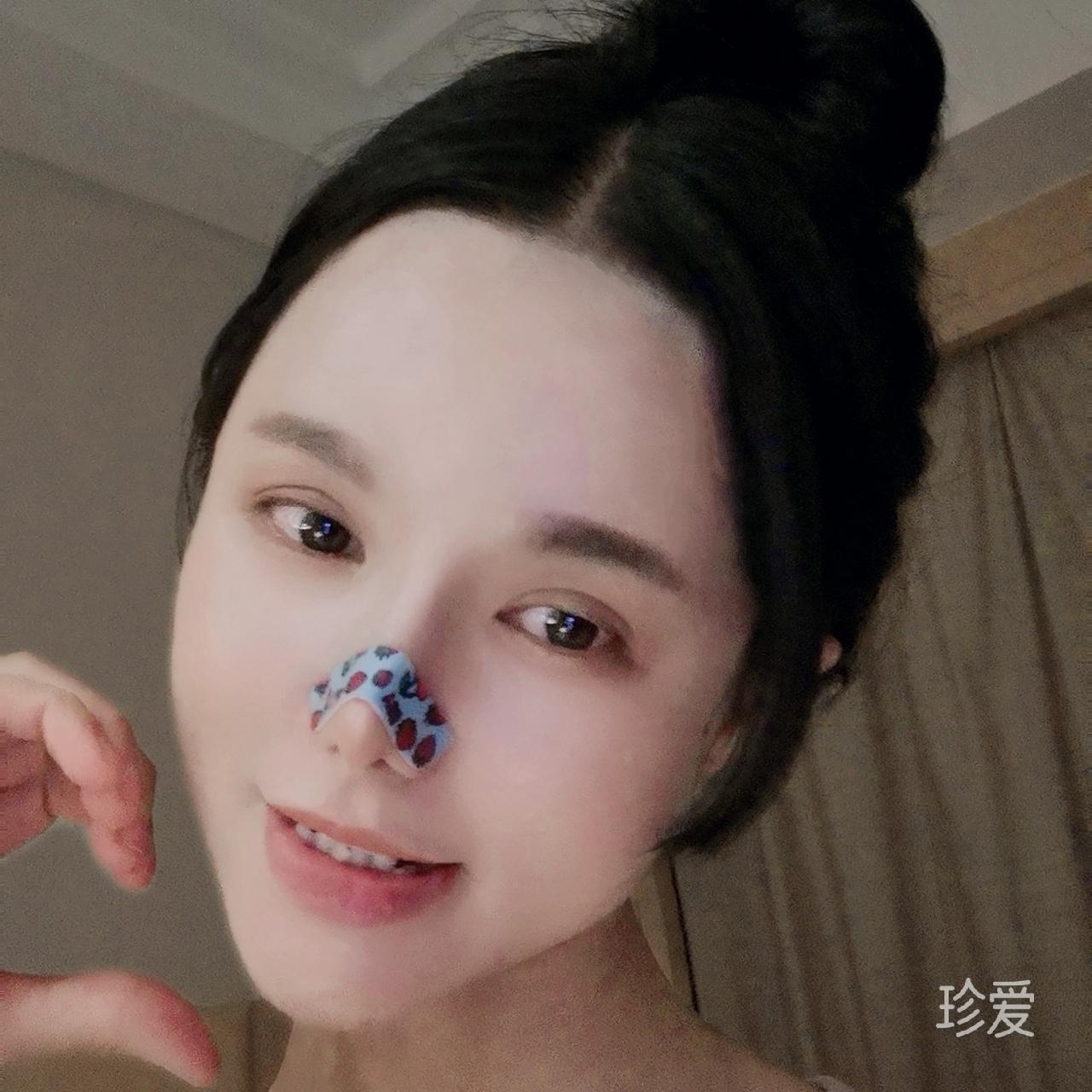 瘦人小土豆