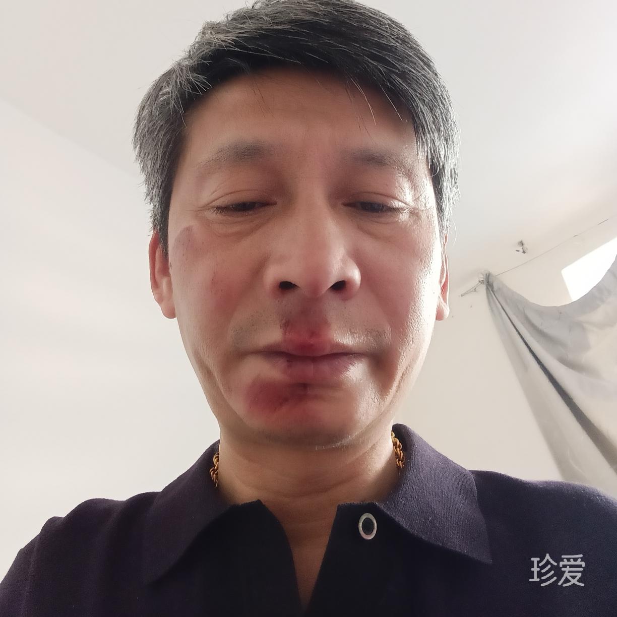 皮皮虾我们走