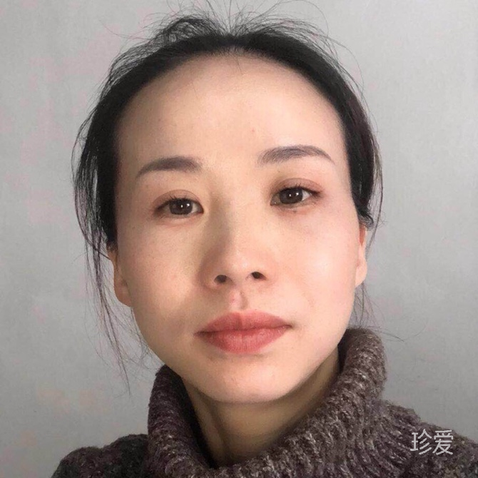 兜兜