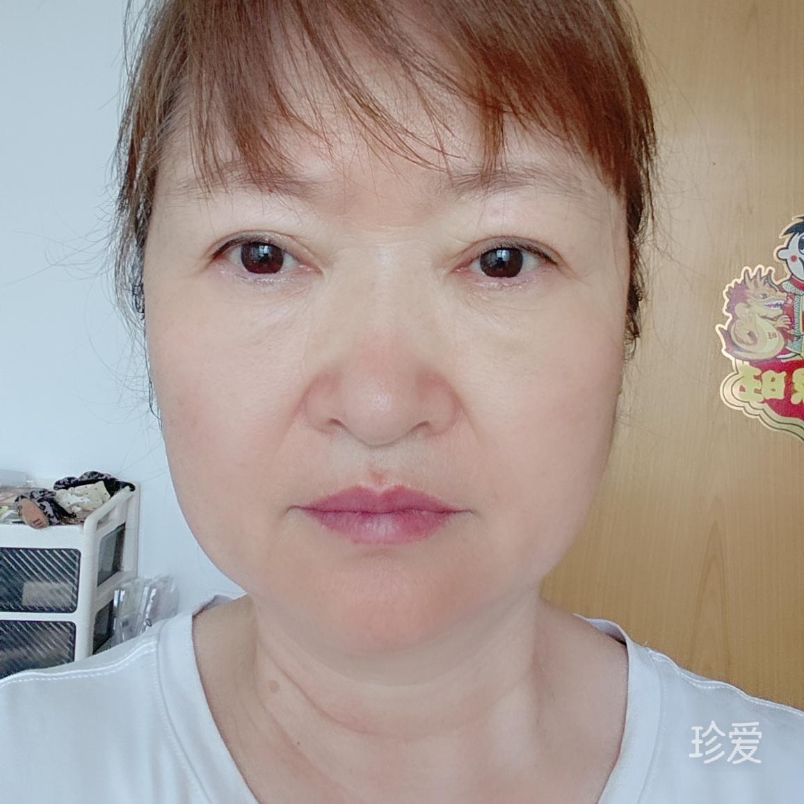 彩虹