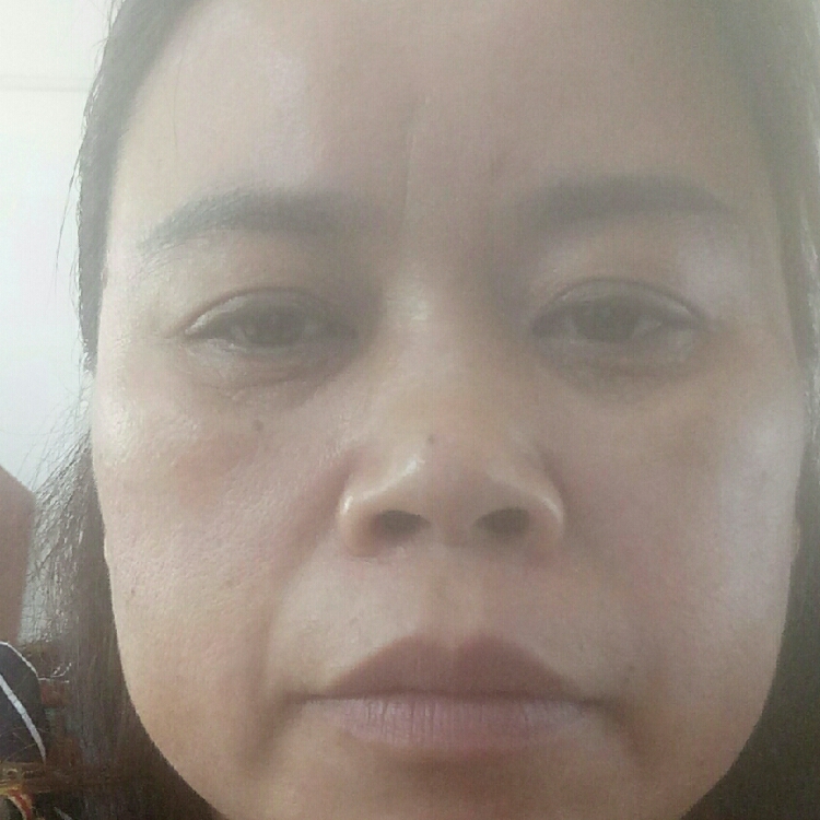 暴風(fēng)雨過(guò)后睛天