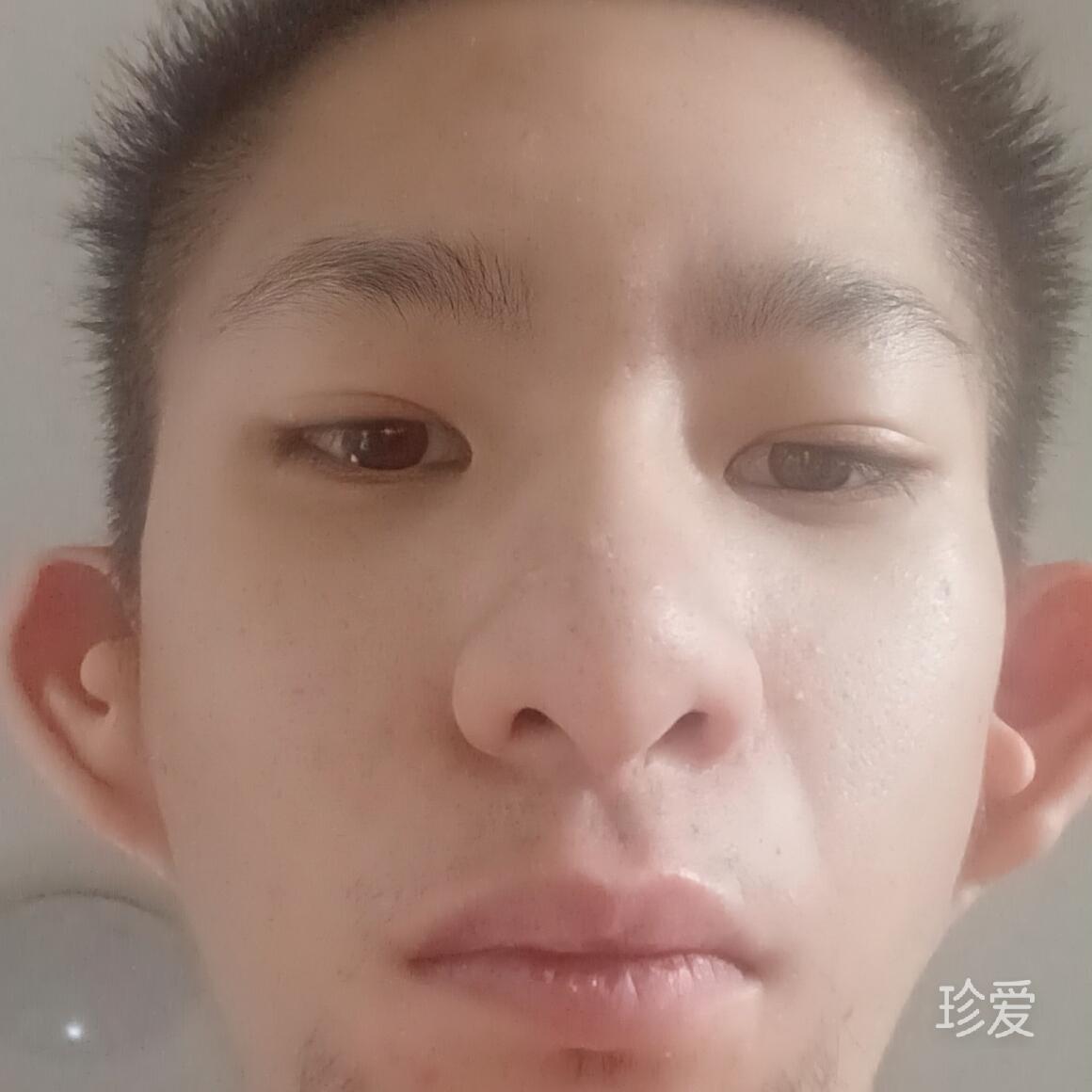 DkinG