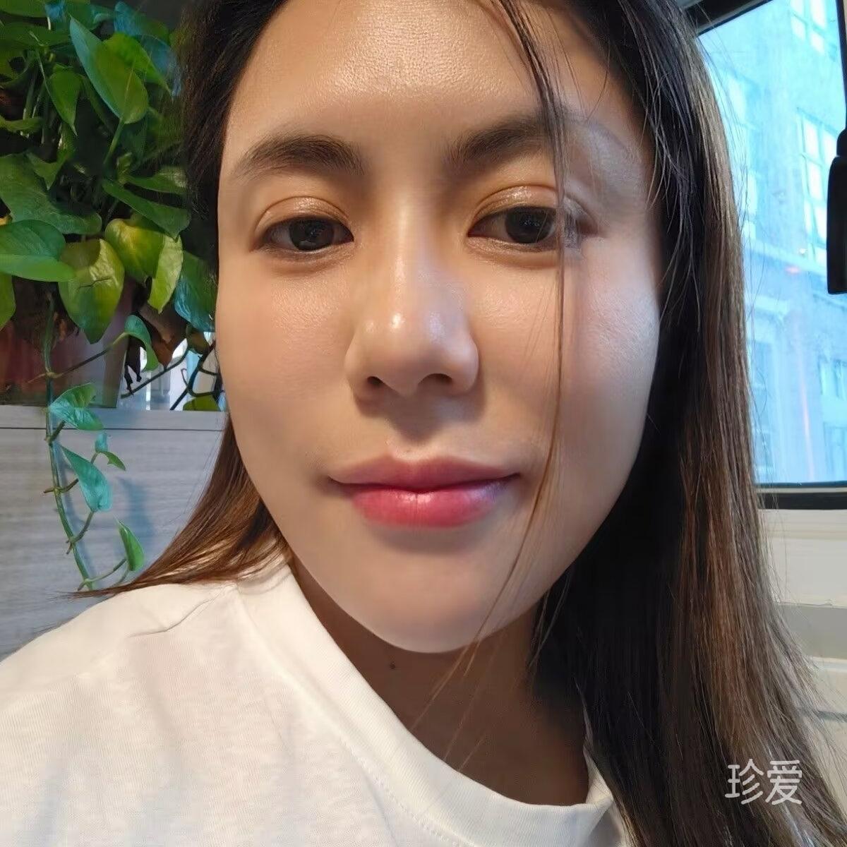 惠子