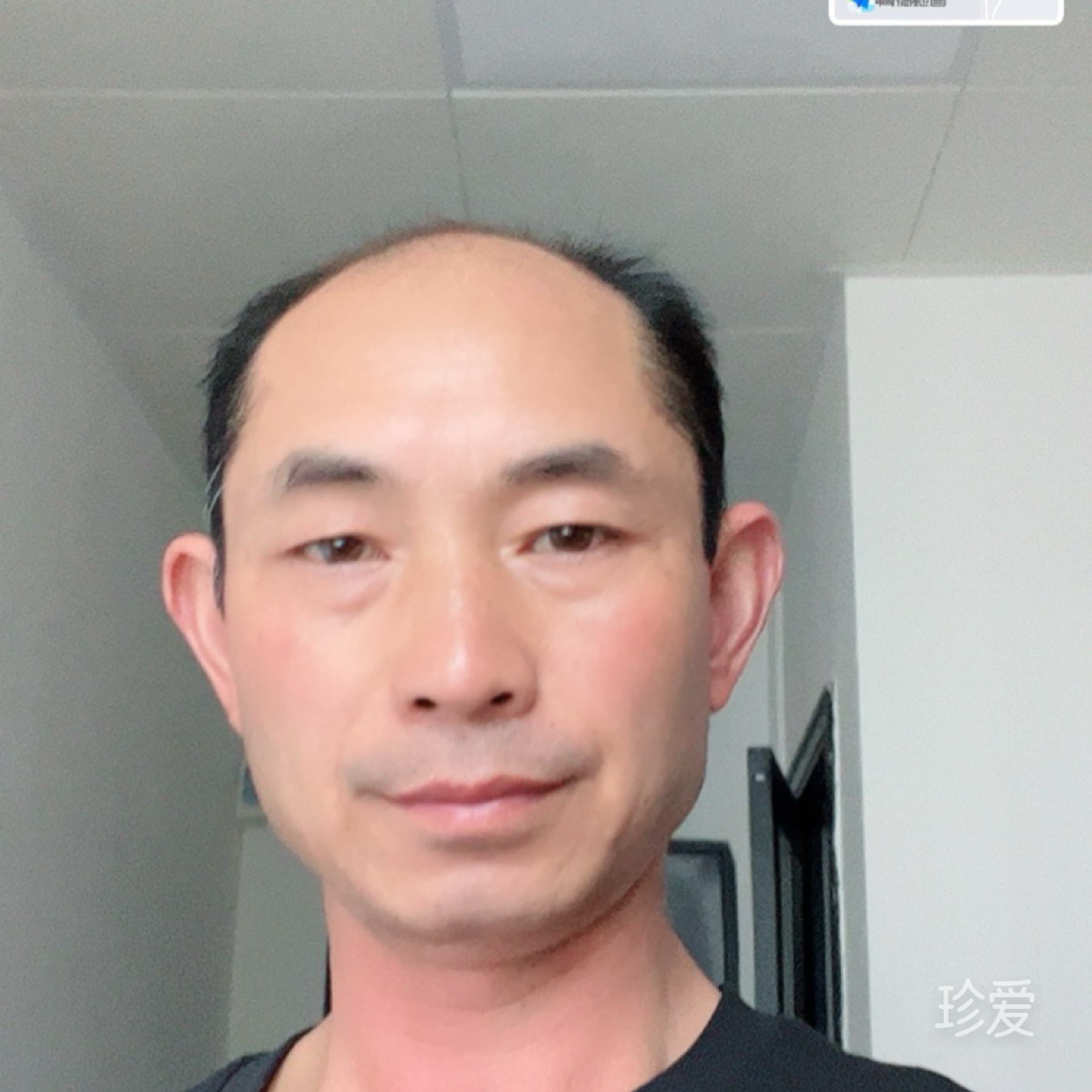 记忆空白式