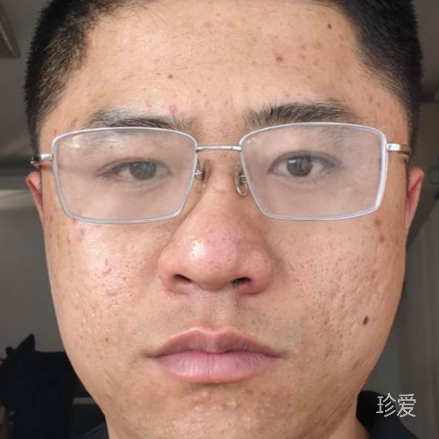 真誠(chéng)的豬豬俠