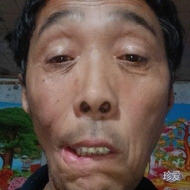 雨晴无阳
