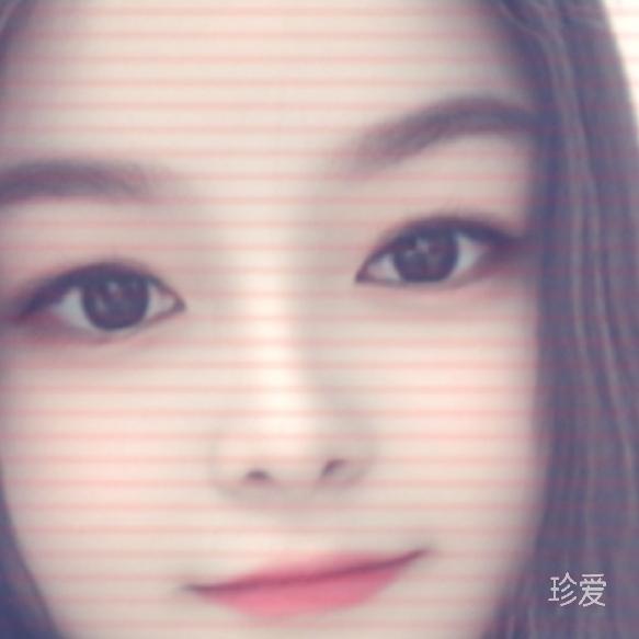 阿玲