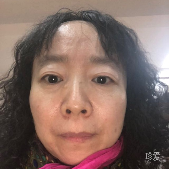 蓝天依旧