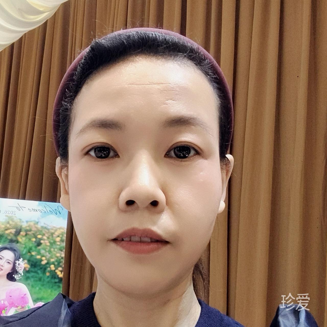 蓝天白云