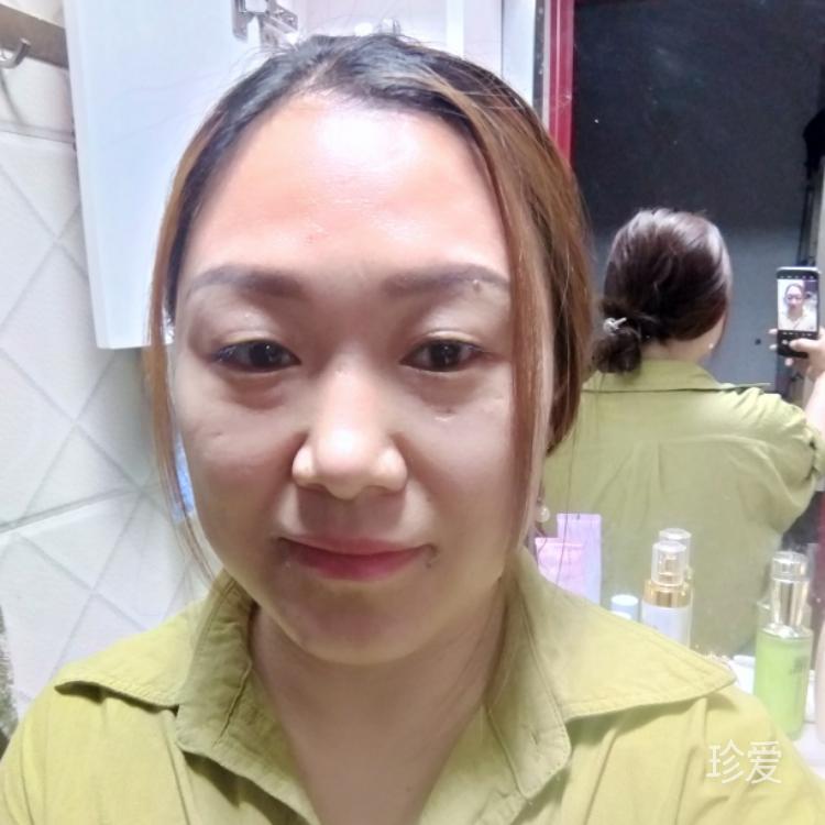 断翅的天使