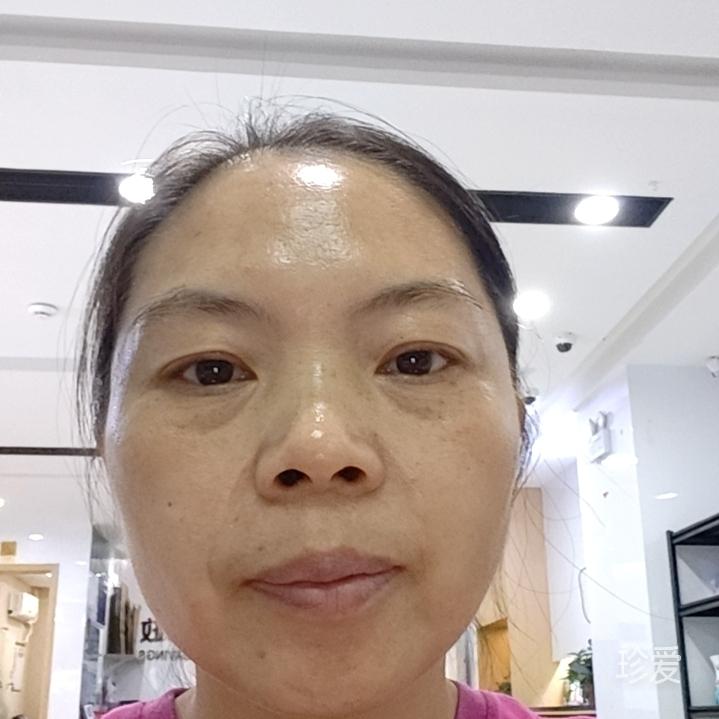 影子