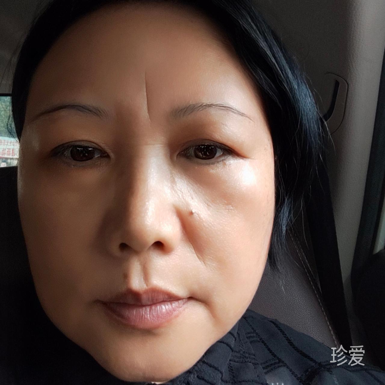 随缘