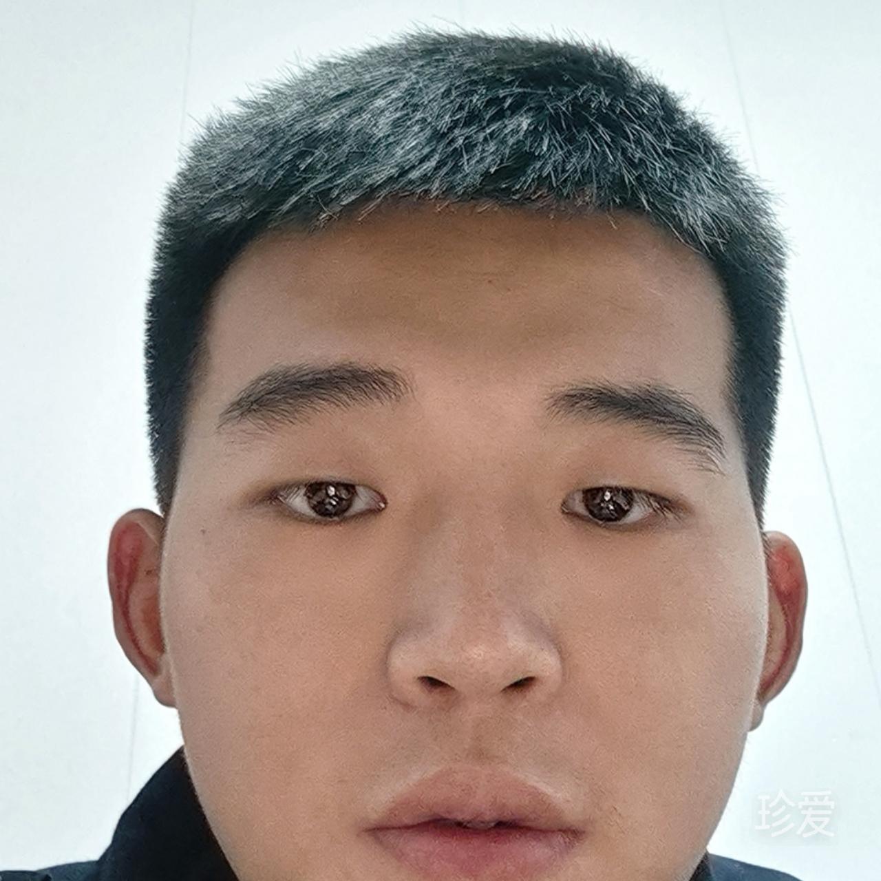 一击碧命