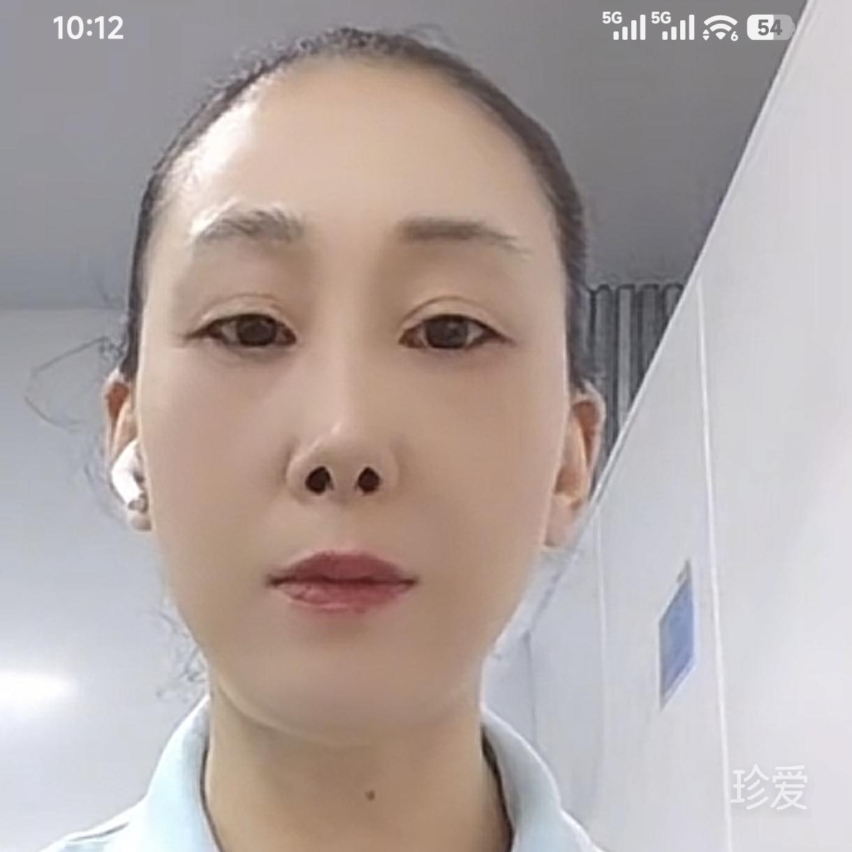 六月的雪