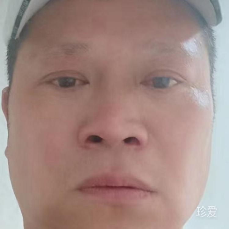 自由天空