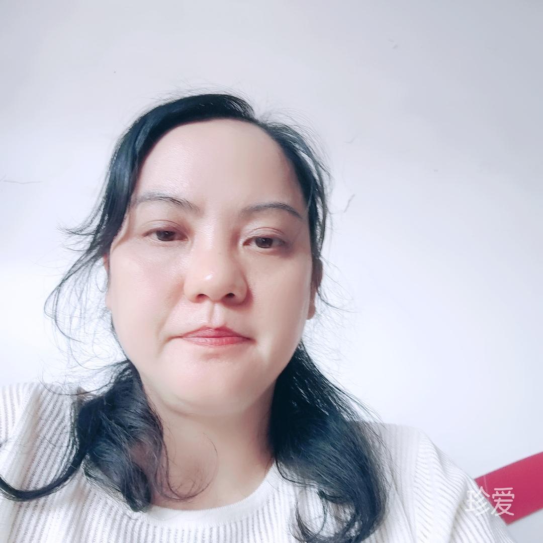 因为是你