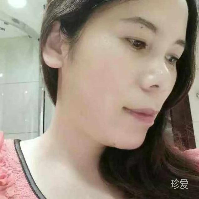 阿琴