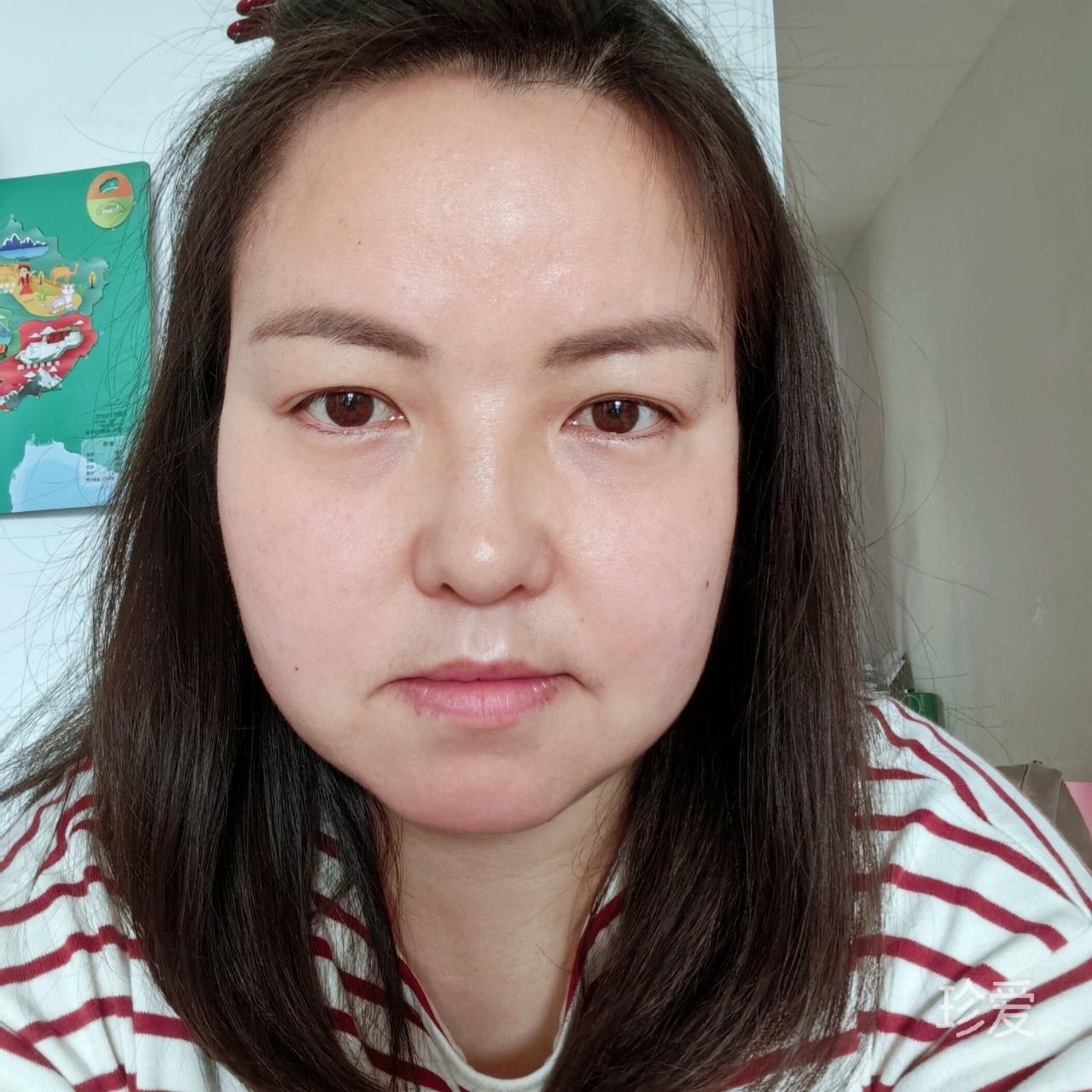 珍昔