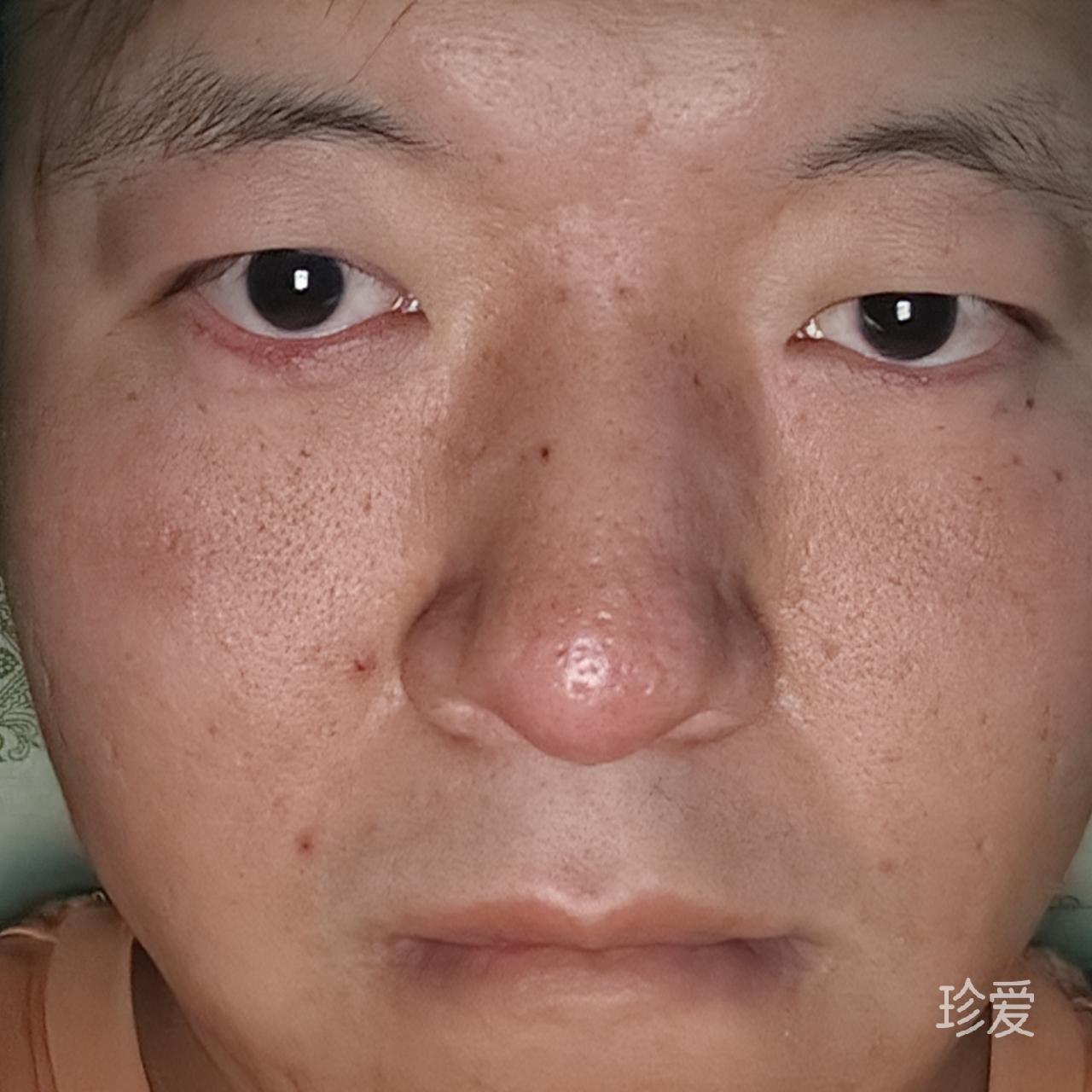 YL丶轩然