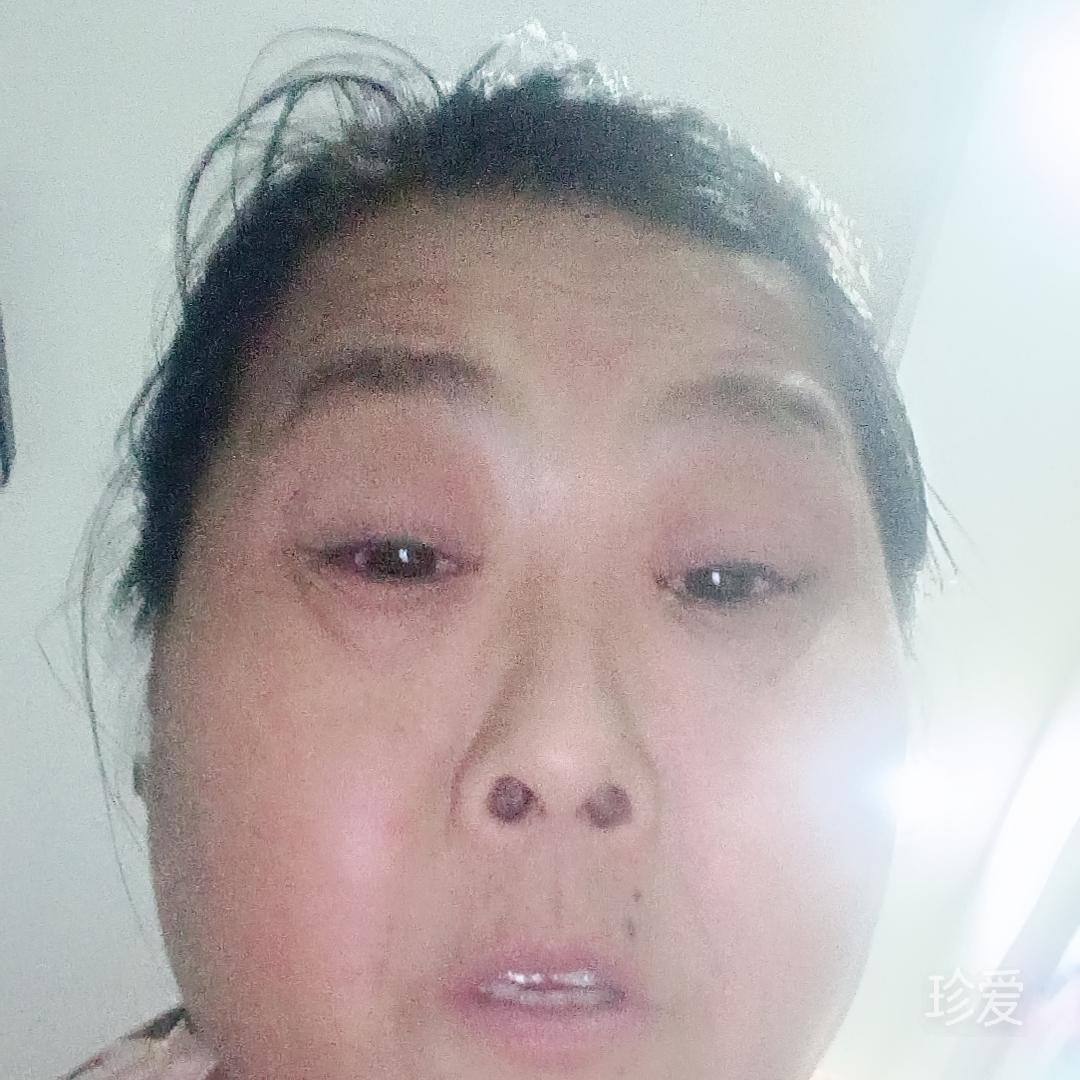 小玄子