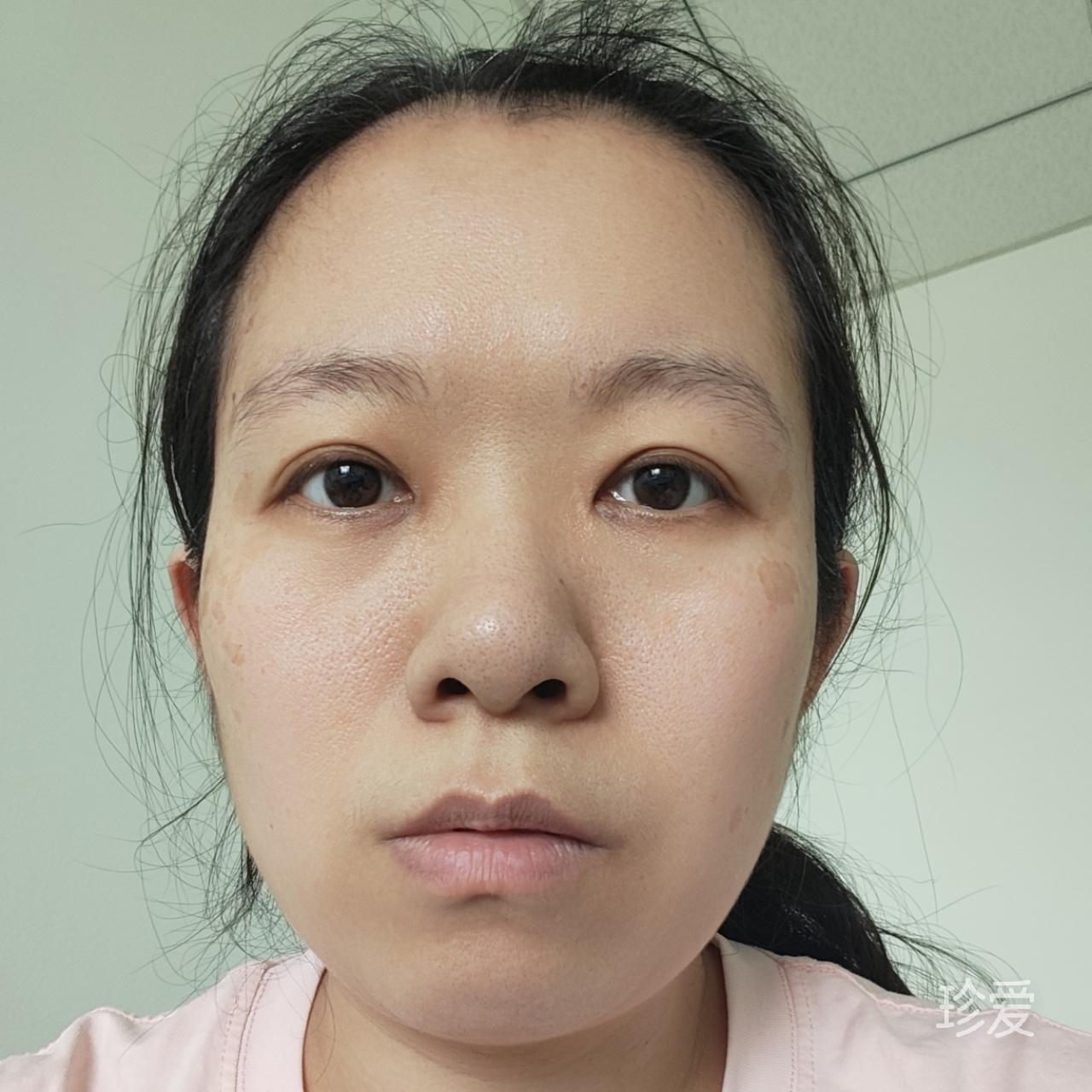 小鑫