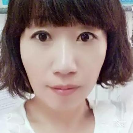 冬眠
