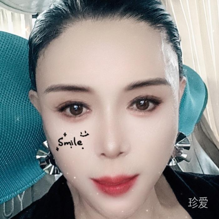 阿菂