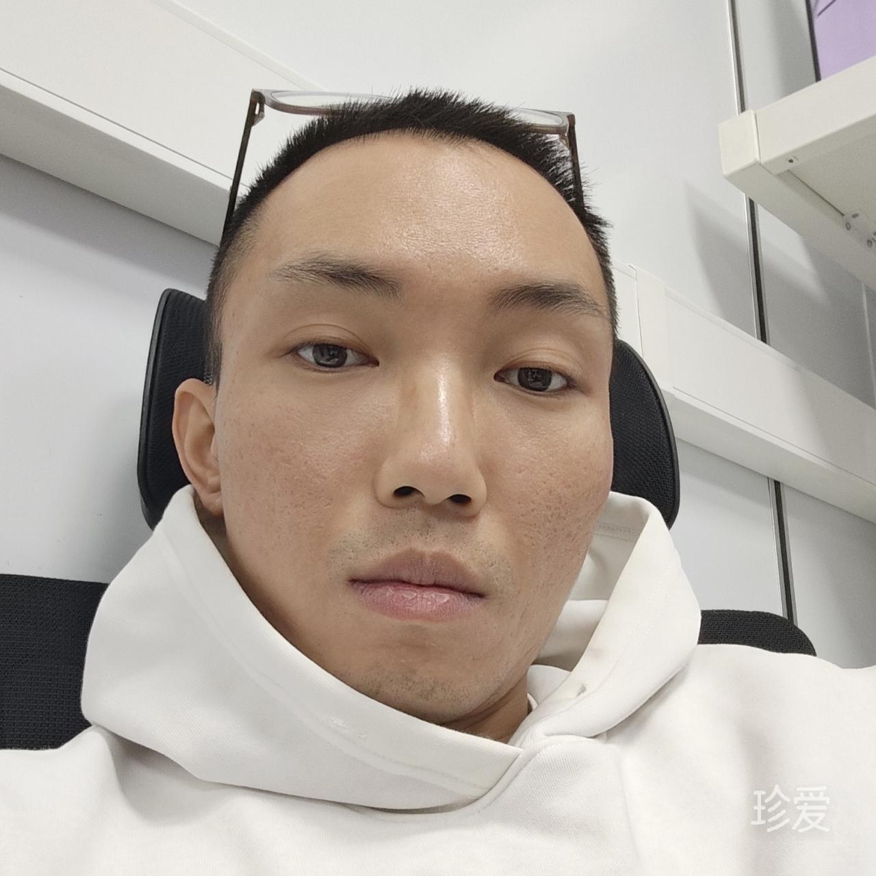 叉叉