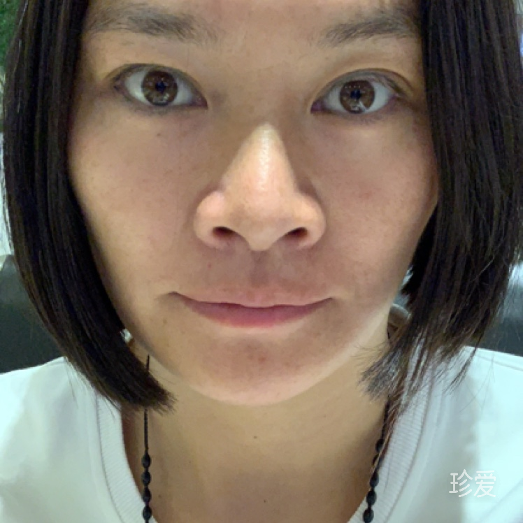 小敏
