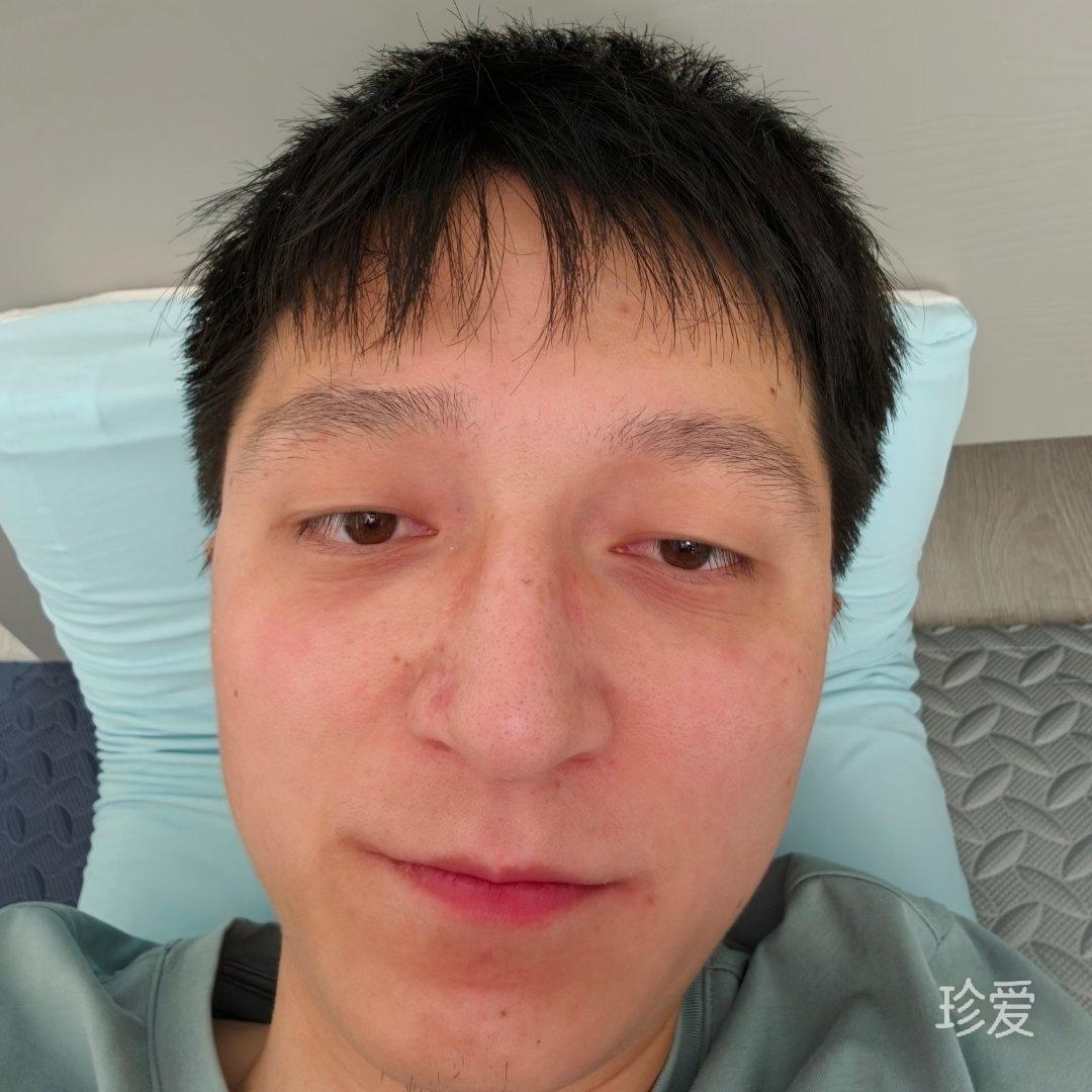 不烧心的兄弟