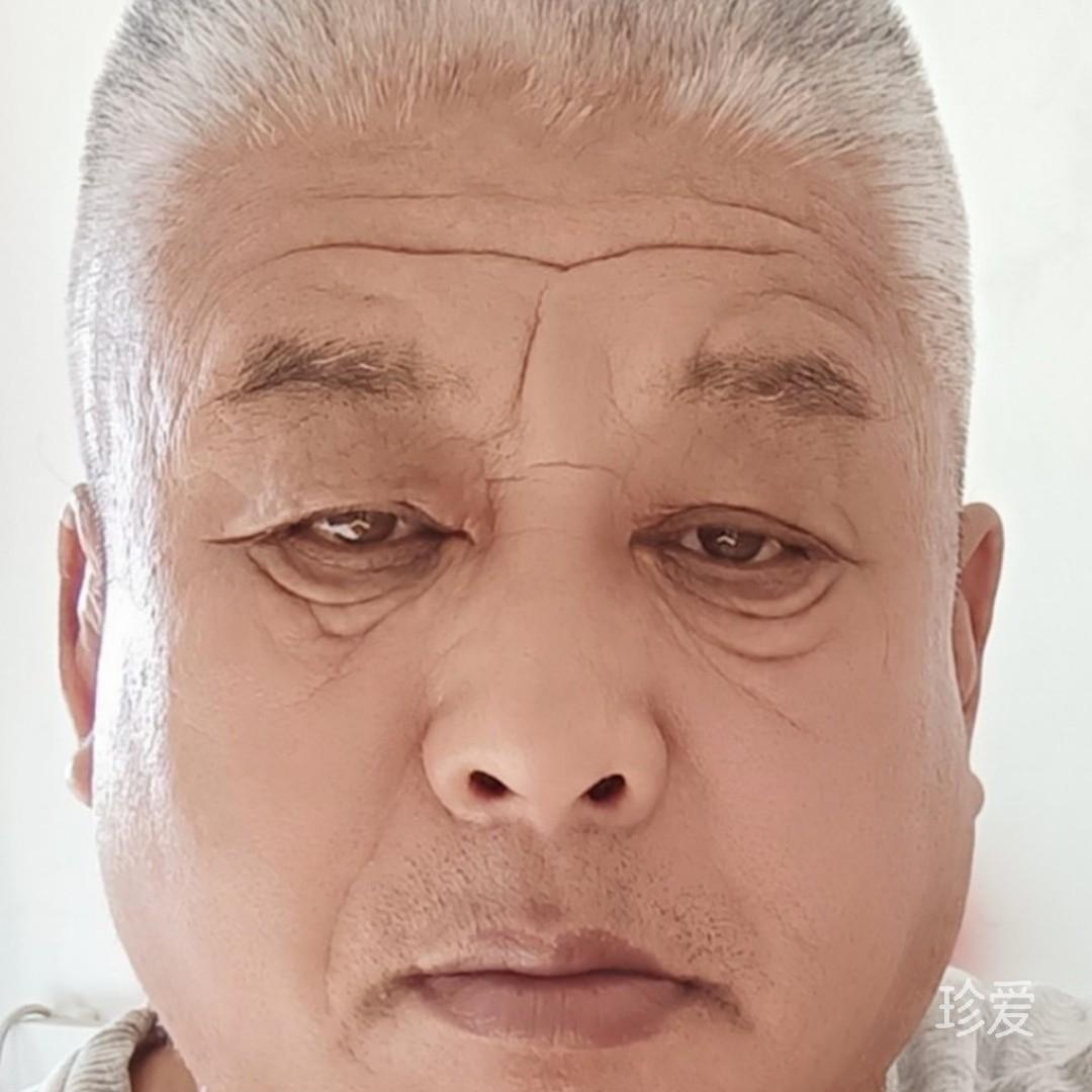 爱在有晴天