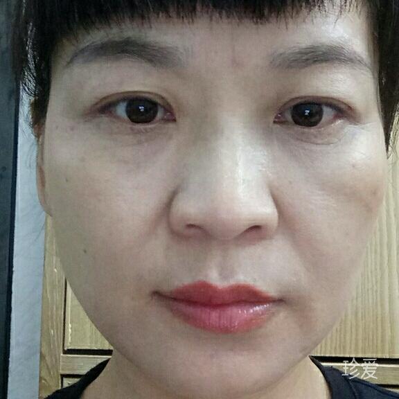 梅梅
