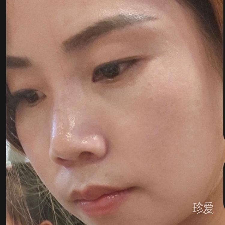 周雪