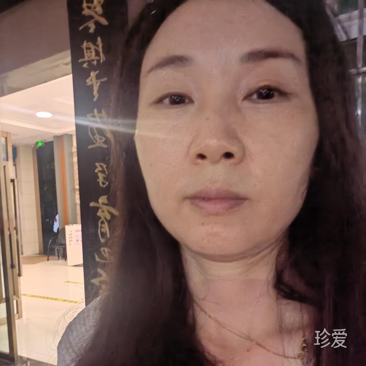 惜