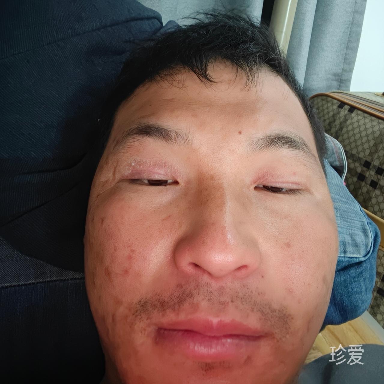 左手边缺点什么