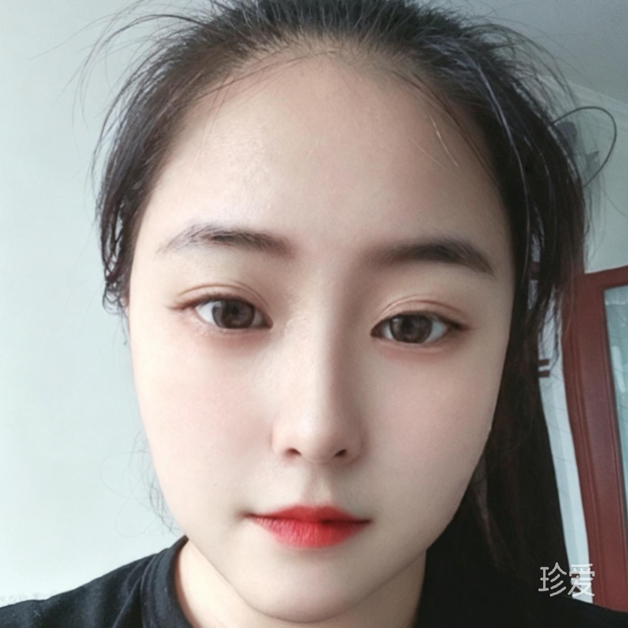 太阳