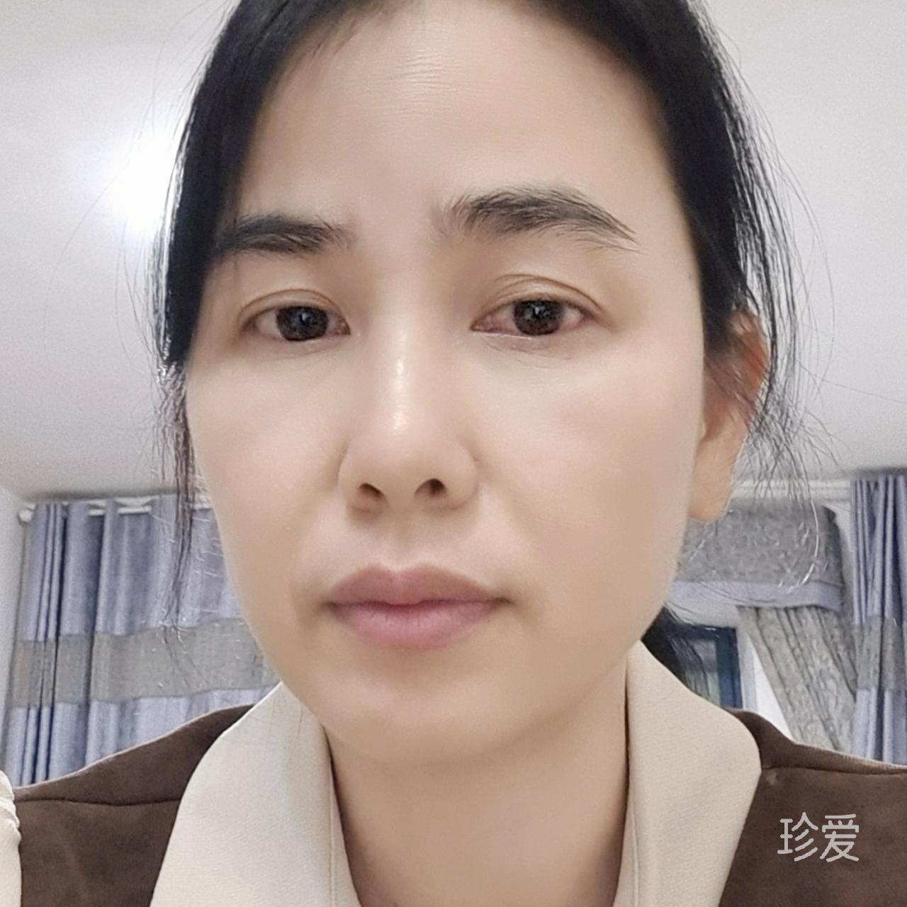 茫然