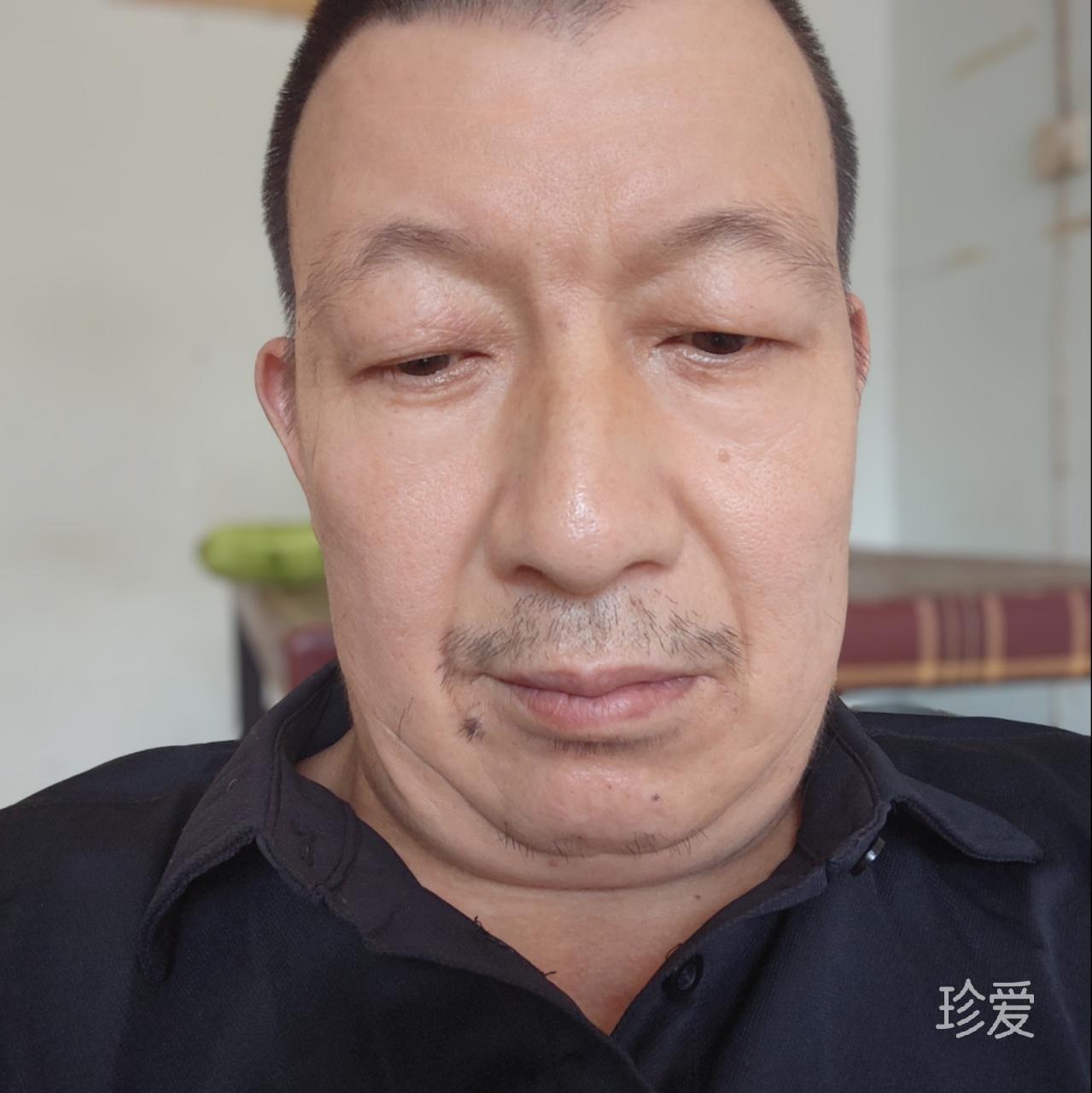 月光