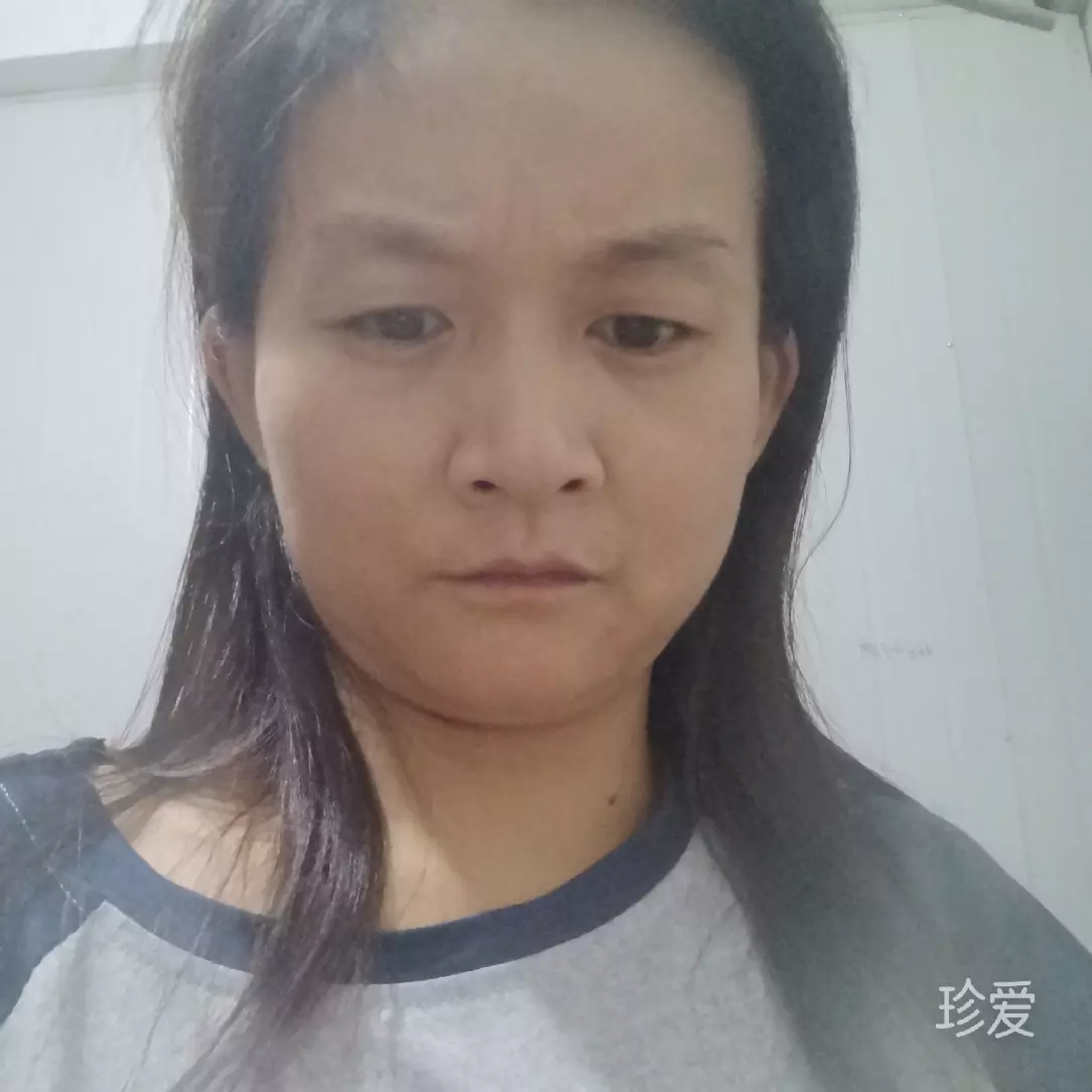 雪源