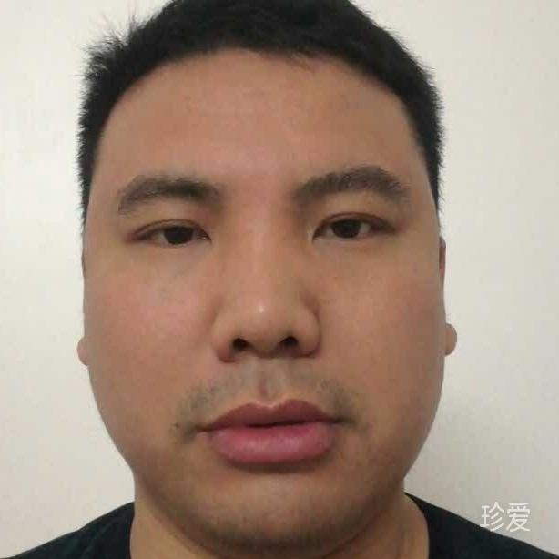 忘无忧